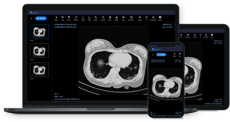 What’s the True Price of Free Medical Image Viewers?